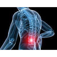 Image result for back pain