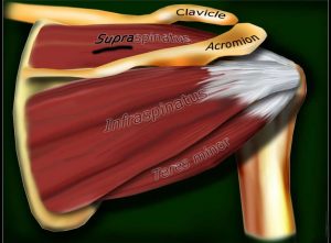 SUPRAspinatus Rotator Cuff Muscle Tendon Injury Tear Treatment Dr. Bock Pain-FREE Shoulder Clinic